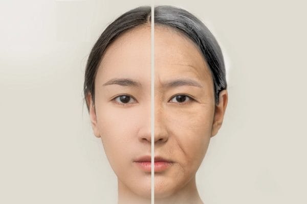 Read more about the article 5 สาเหตุหน้าแก่เร็ว ทำไมหน้าแก่เร็ว จะบอกให้รู้!